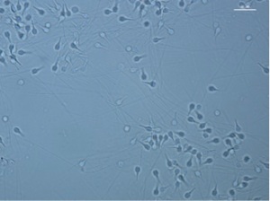 Figura 5. Espermatozoides de M. galloprovincialis 